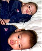 The 'Kilshaw twins'