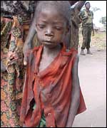 Malnourished boy