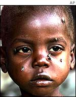 Starving boy