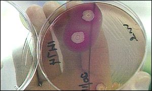 E. coli