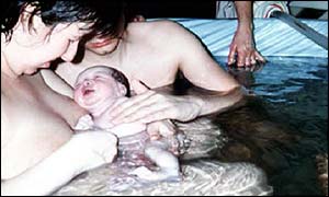 Water birth
