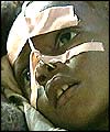 A sick Angolan child 