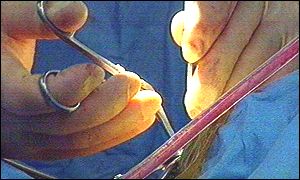 Plastic surgery