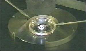 IVF