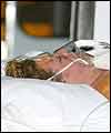 An Australian burns victim