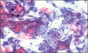 Smear test