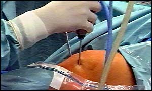 Surgery