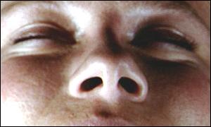 Nose
