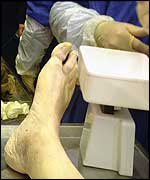 Cadaver's foot