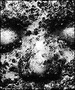 smallpox