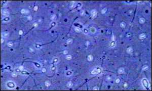 Sperm cells