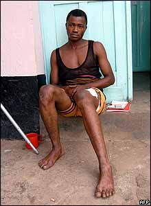 Injured DR Congolese Army soldier in Bukavu General Hospital