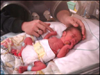 Jack in his incubator.