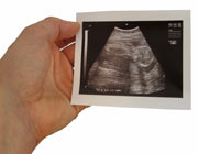Hand holding an ultrasound image of a foetus. Image credit: iStockphoto/Lari Kemilainen