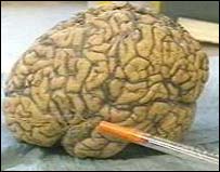 انسانی دماغ