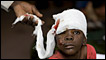Niña herida en Puerto Príncipe