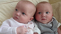 The 100th set of twins to be included in the Bradford Heath Survey