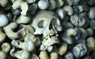 Photograph showing a human skull amongst various other human remains