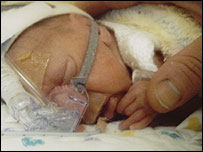 Premature baby Ethan Edward Elvis Currill