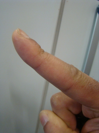L-FINGER1.JPG