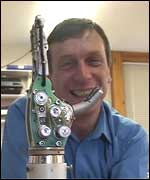 Kevin and his mechanical hand