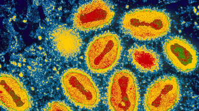 The Smallpox Virus