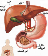 زردی سياه