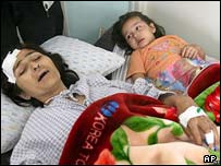 زخمی های انفجار کابل