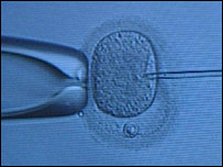 تحقيقات جنينی