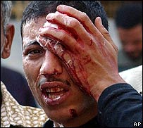 ایک زخمی ووٹر