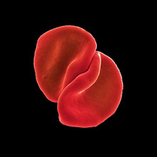 Review of Scratch My Back Review of Scratch My Back