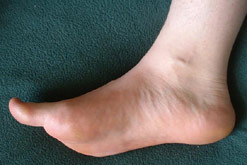 Side view of a foot