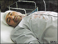 يکی از زخمی شدگان بمبگذاری در کرمانشاه