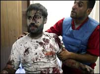 Ferido em Ghaziyeh