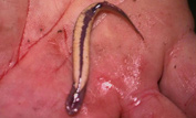 The parasitic catfish known as candiru