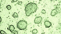 Embryonic stem cells, seen under a microscope