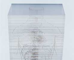 Photo a surgically dissected trunk of a body encapsulated in clear acrylic slabs.