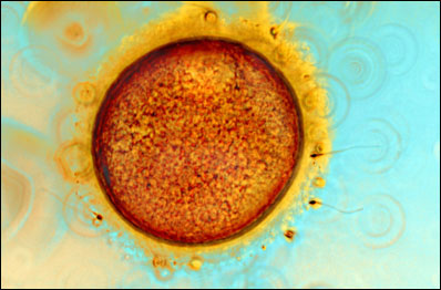 Óvulo e espermatozóide (Foto: M I Walker/Wellcome Image Awards 2009)