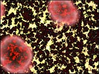 Brain section with CJD c/o BBC Science Library