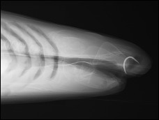 X-ray