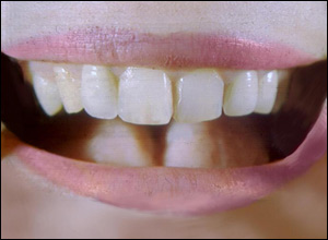 mouth_300.jpg