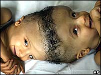 दोनों के सिर अलग किए जाएंगे