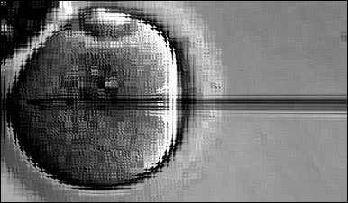 Штучне запліднення яйцеклітини