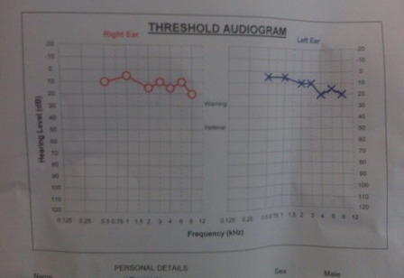 audiogram.jpg