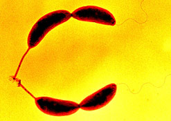 The Caulobacter crescentus bacterium (Yves Brun)