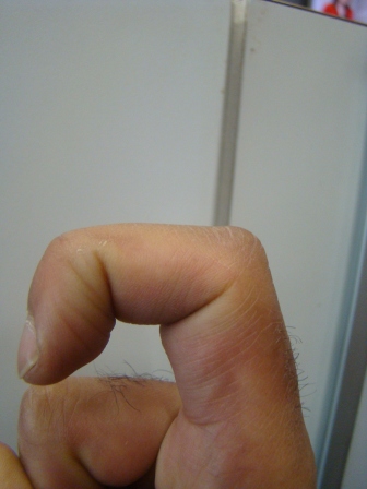 L-FINGER2.JPG