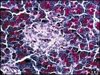 سلول های لوزالمعده