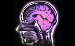 How is the brain affected by epilepsy?