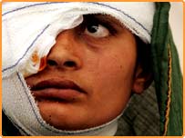 زلزلے کی ایک زخمی عورت