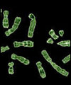 Human chromosomes